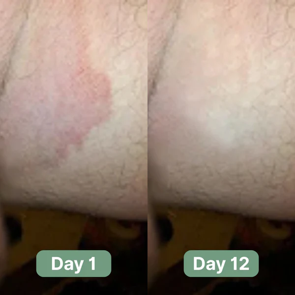Cougex® Antifungal Cleansing Bar